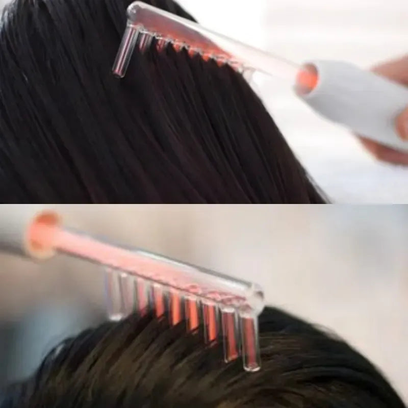 Dile adiós a la caída del cabello y control de caspa con la TERAPIA DE ALTAFRECUENCIA